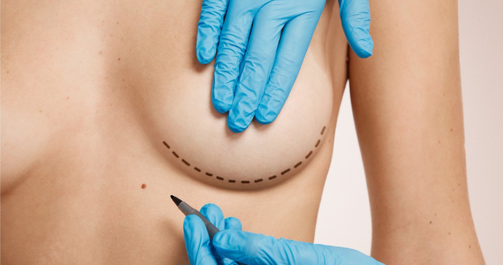 Best Cosmetic Surgeon In Bangalore